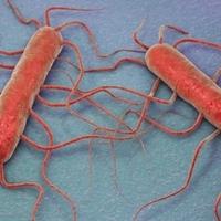 Simptomi trovanja listerijom: Šta je bakterija iz kajmaka zbog koje je petero ljudi umrlo u Austriji