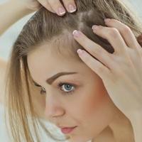 Pet prirodnih načina da spriječite gubitak kose
