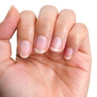 Evo šta boja noktiju govori o vašem zdravlju: Crni nokti ukazuju na bolesti srca
