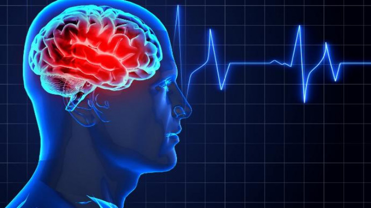 Neliječena hipertenzija povećava rizik od hemoragijskog moždanog udara