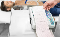 EKG je zapis s 12 linija koje nam govore o različitim aspektima stanja srca